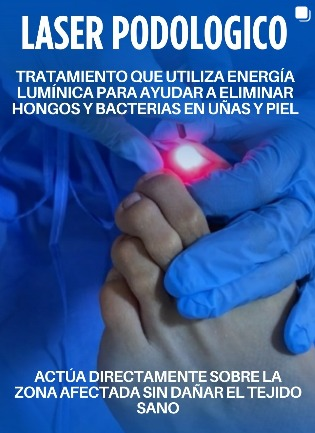 Aplicación de tratamiento láser podológico